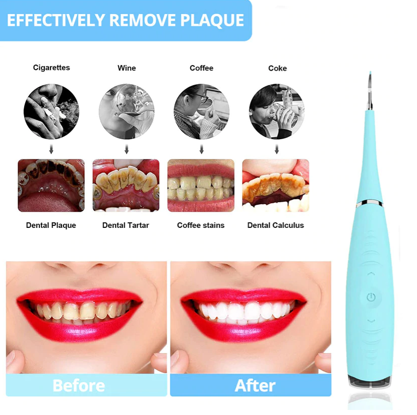 dental calculus remover