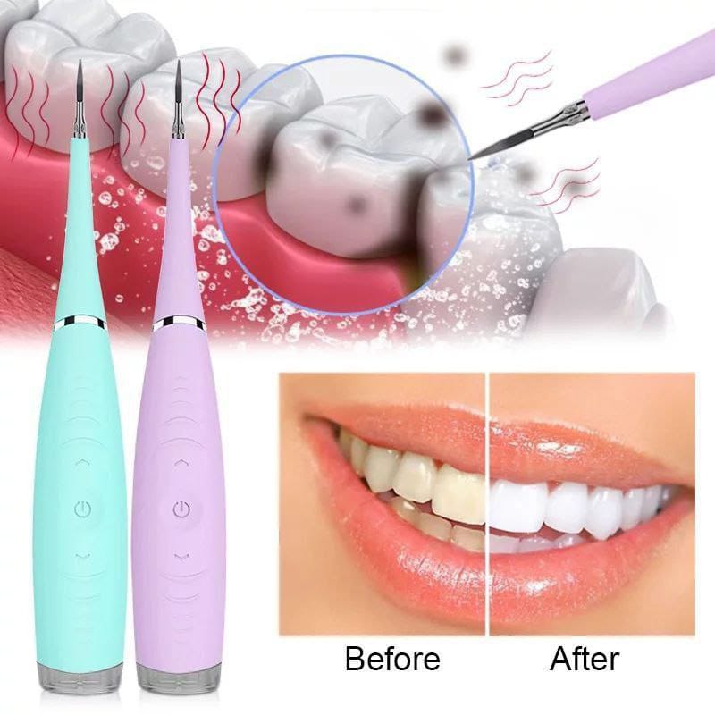 dental calculus remover