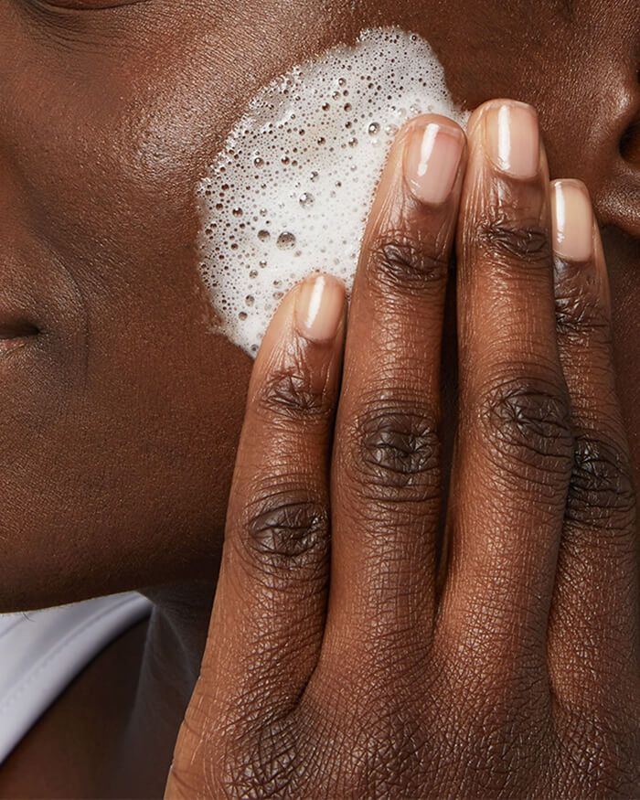 Crème nettoyante moussante contre l'acné TRAITEMENT DE L'ACNÉ AU PEROXYDE DE BENZOYLE